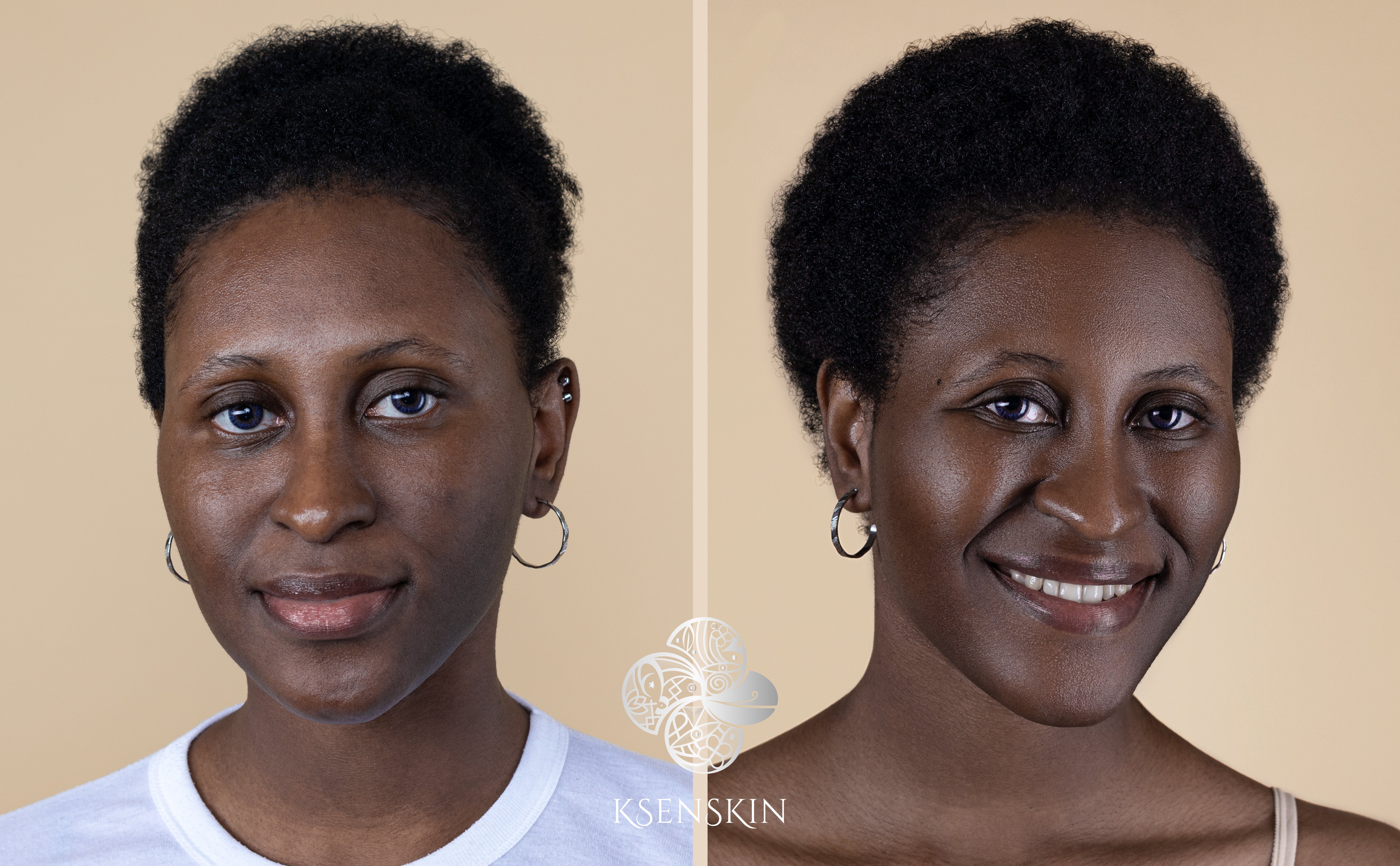Blue Lotus Magic before and after on dark skin